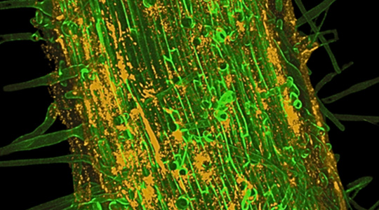 Stressed-Out Soil Bacteria Adapt to Environmental Conditions